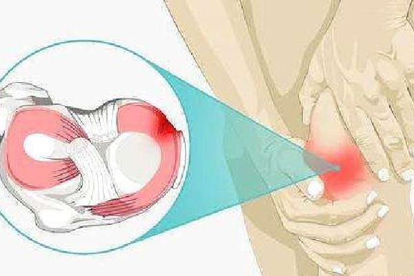 徐梦桃摘金背后:半月板切除70% 半月板损伤怎么造成的